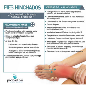 Infografía sobre pies hinchados