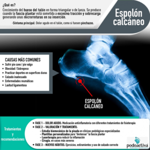 infografia espolon calcaneo