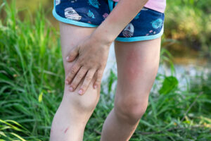 dolor-rodilla-desarrollo-infantil